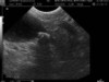 Ultrassonografia Abdominal e Pélvica de Pequenos Animais